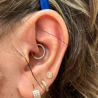 Aro Clicker con Zirconias de frente- Titanio